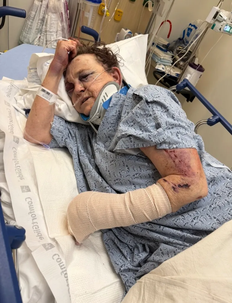 Theresa Garcia in a hospital bed with severe injuries, including bruises and cuts on her face, a neck brace, and a bandaged arm.