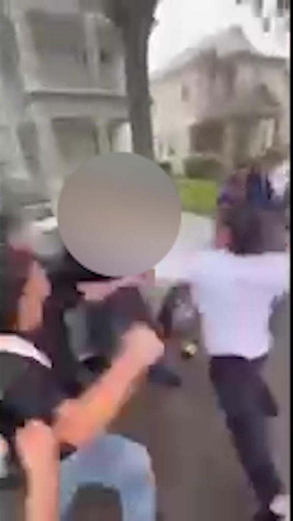 The victim received 11 stitches to the face after the beating.